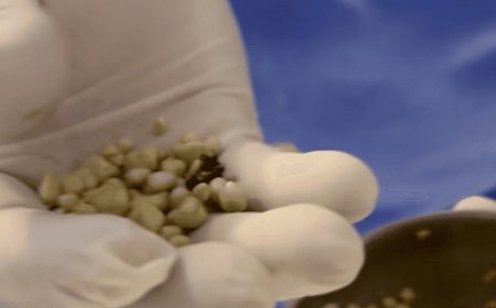 الإفراط في المشروبات الغازية يؤدي لاستخراج 30 حصوة من كلية رجل