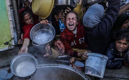 غزة: ارتفاع ضحايا التجويع وسوء التغذية إلى 20 خلال 48 ساعة