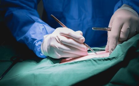 "شفايف وصدر منفوخ وقانون!".. الأمن العراقي يُلاحق اطباء التجميل