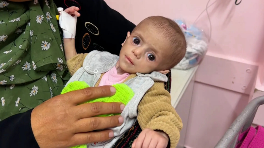 غزة تنهار تحت الحصار: الجوع يفتك بالأجساد وأطفال يموتون بصمت