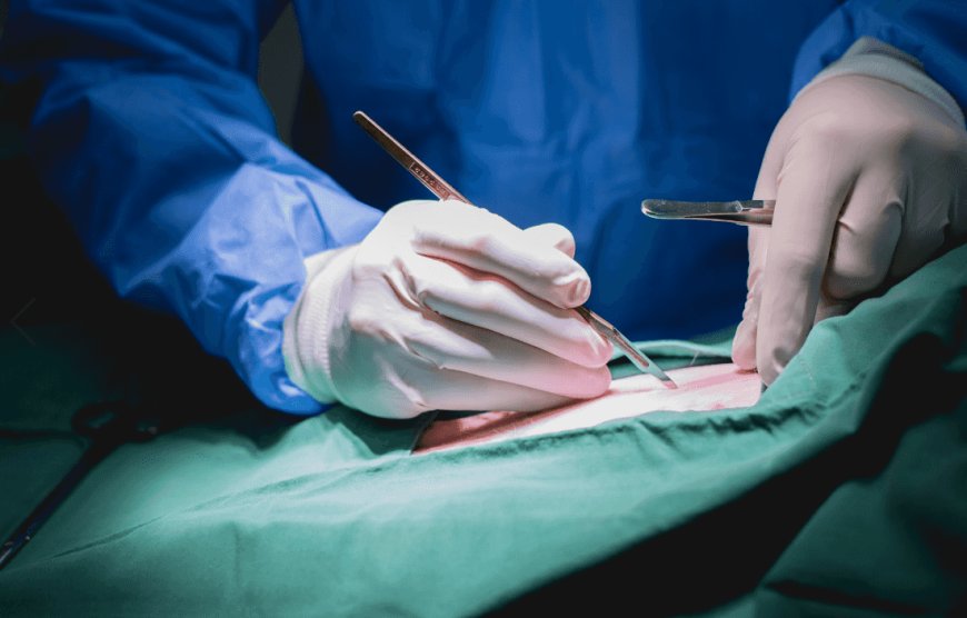 "شفايف وصدر منفوخ وقانون!".. الأمن العراقي يُلاحق اطباء التجميل