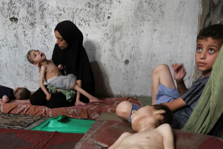 ارتفاع وفيات المجاعة في غزة إلى 133 بينهم 87 طفلاً