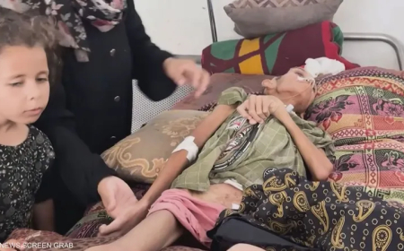 يونيسيف: غزة دخلت مرحلة ما بعد المجاعة وأطفالها يموتون جوعاً