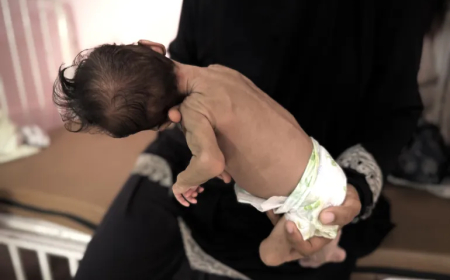 المجاعة تحصد مزيداً من الأرواح في غزة: 5 وفيات جديدة لترفع الحصيلة إلى 180 ضحية
