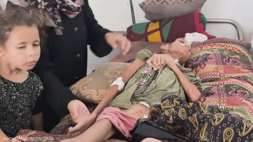 يونيسيف: غزة دخلت مرحلة ما بعد المجاعة وأطفالها يموتون جوعاً