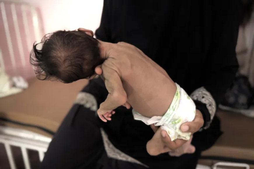 المجاعة تحصد مزيداً من الأرواح في غزة: 5 وفيات جديدة لترفع الحصيلة إلى 180 ضحية