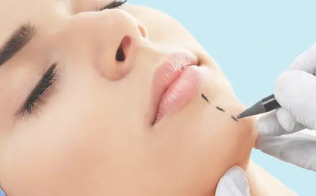 نقابة الأطباء تمنع نشر صور عمليات التجميل وتتوعد المخالفين