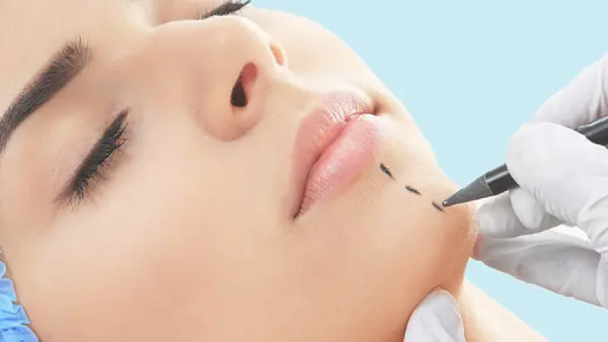 نقابة الأطباء تمنع نشر صور عمليات التجميل وتتوعد المخالفين